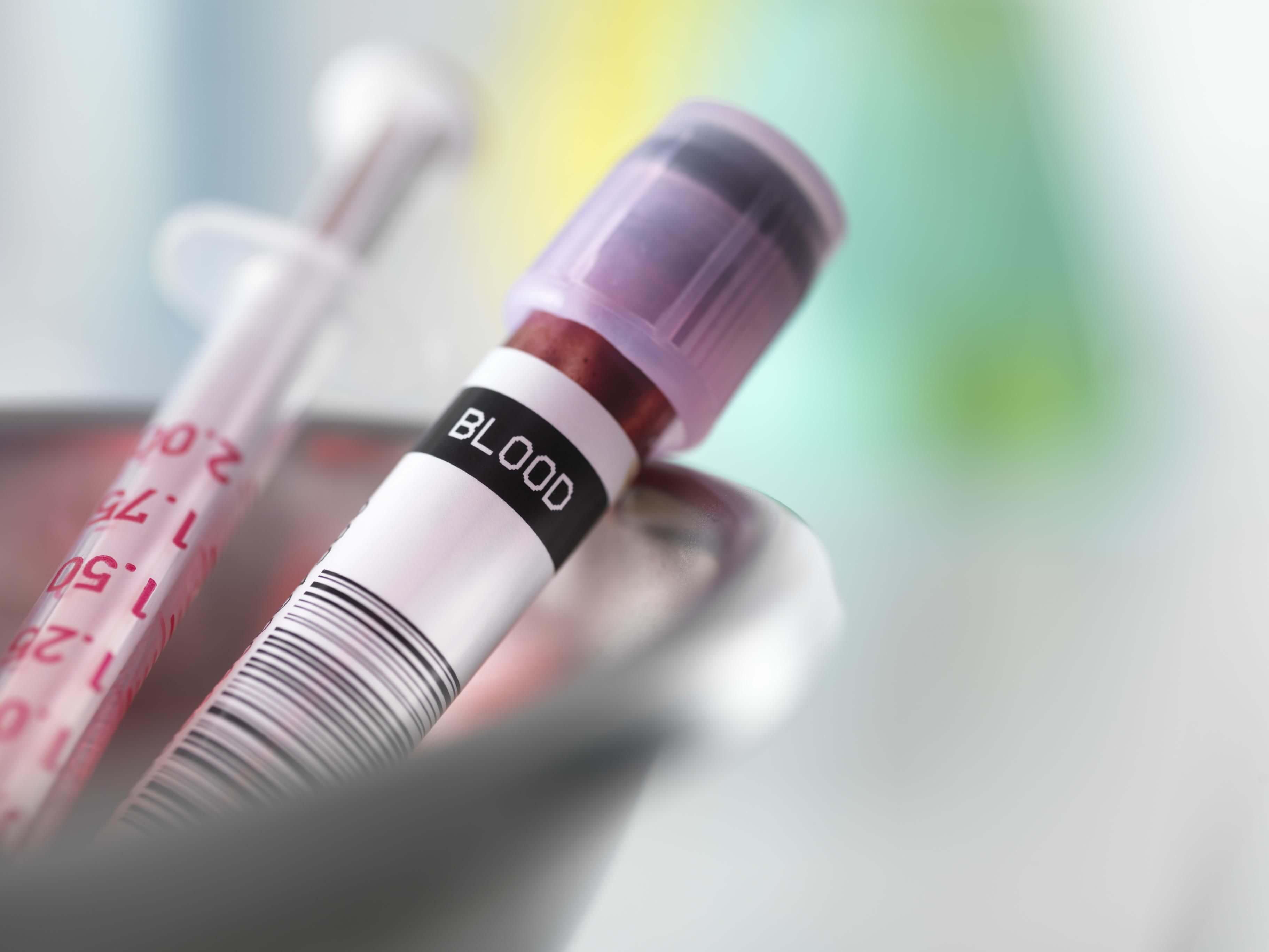 Blood tests for PCOS
