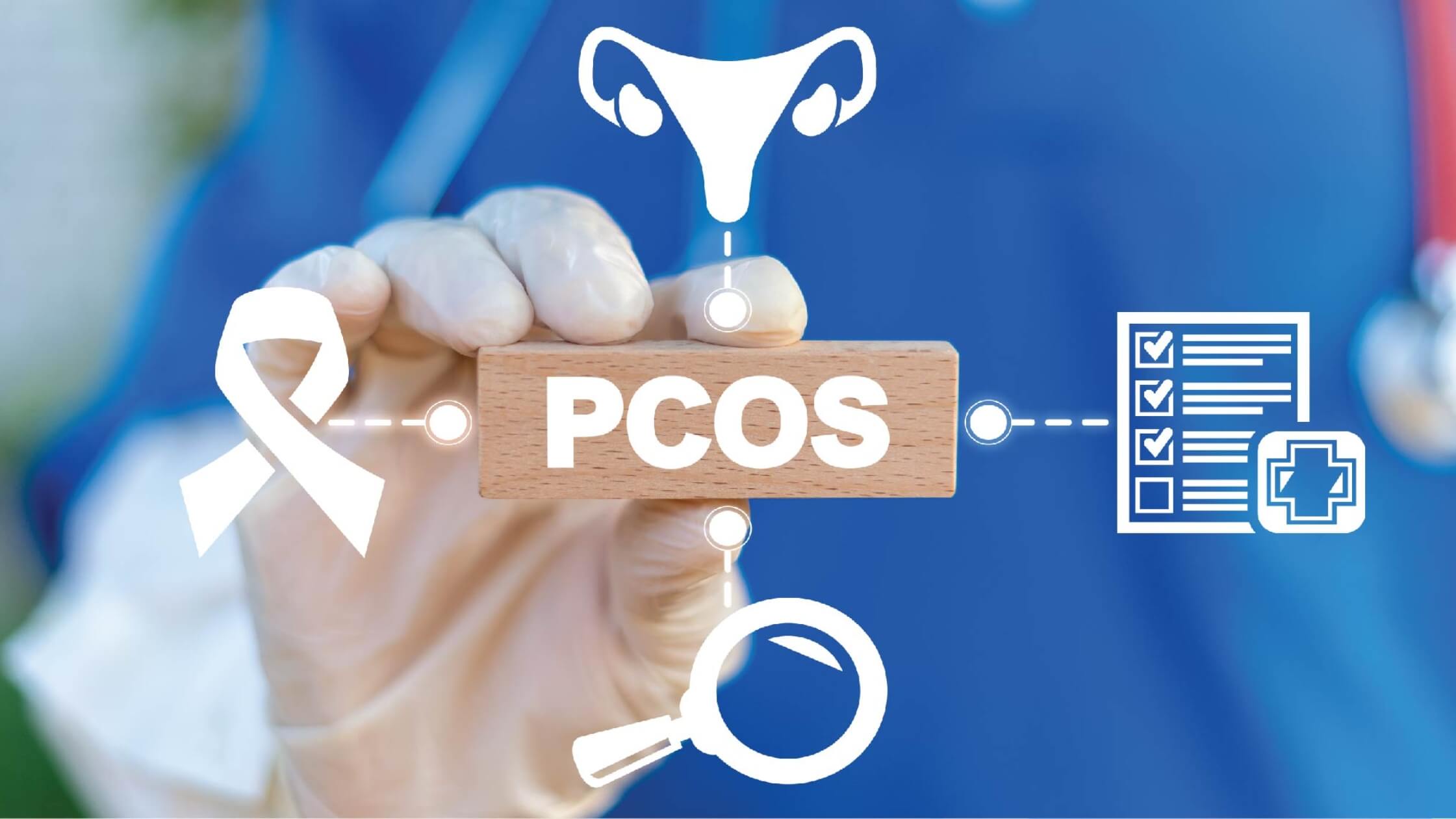 PCOS - Polycystic Ovarian Syndrome